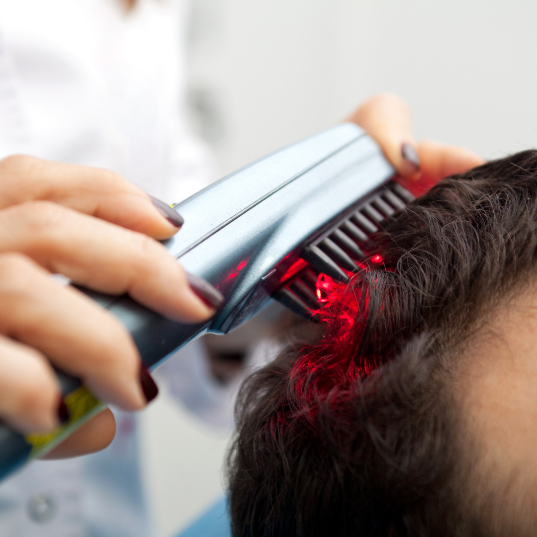 Low Level Laser hair therapy in Bangalore